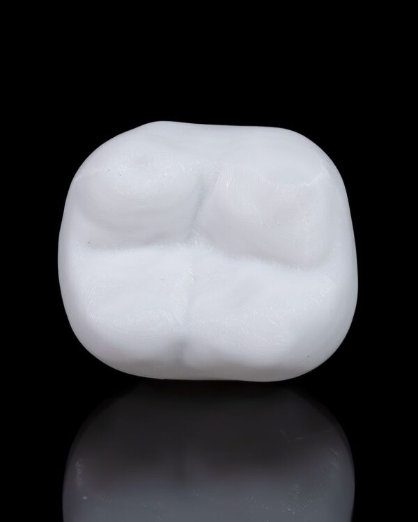 Dental Implant Model - Image 6