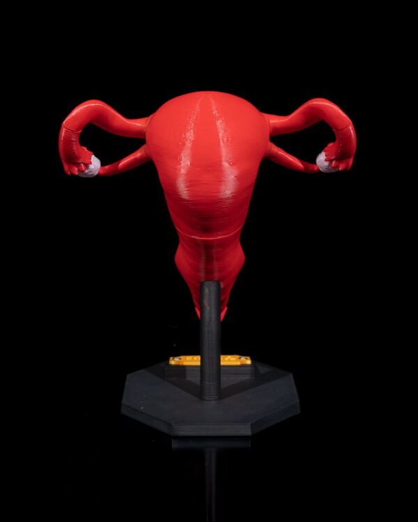Uterus 3D Model - Image 4
